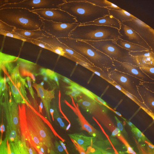 Model neuroinflammation in the SynBBB Blood-Brain-Barrier Model and measure changes in barrier integrity using permeability, TEER and neutrophil adhesion and migration.  Read Tang et al, 2018 in Neuroinflammation below. #SynVivo
synvivobio.com/protein-kinase…