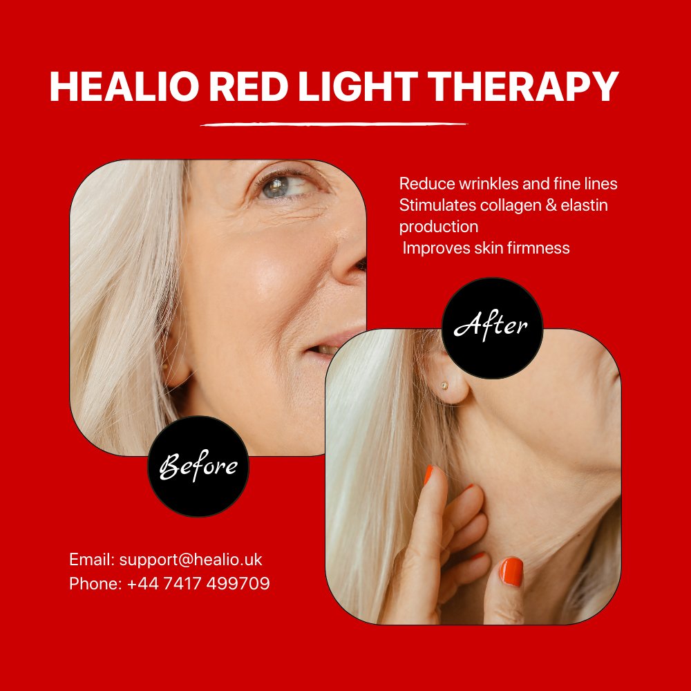 Healio_uk's tweet photo. #healio #redlighttherapy #review https://t.co/o9Ro0I4xBV