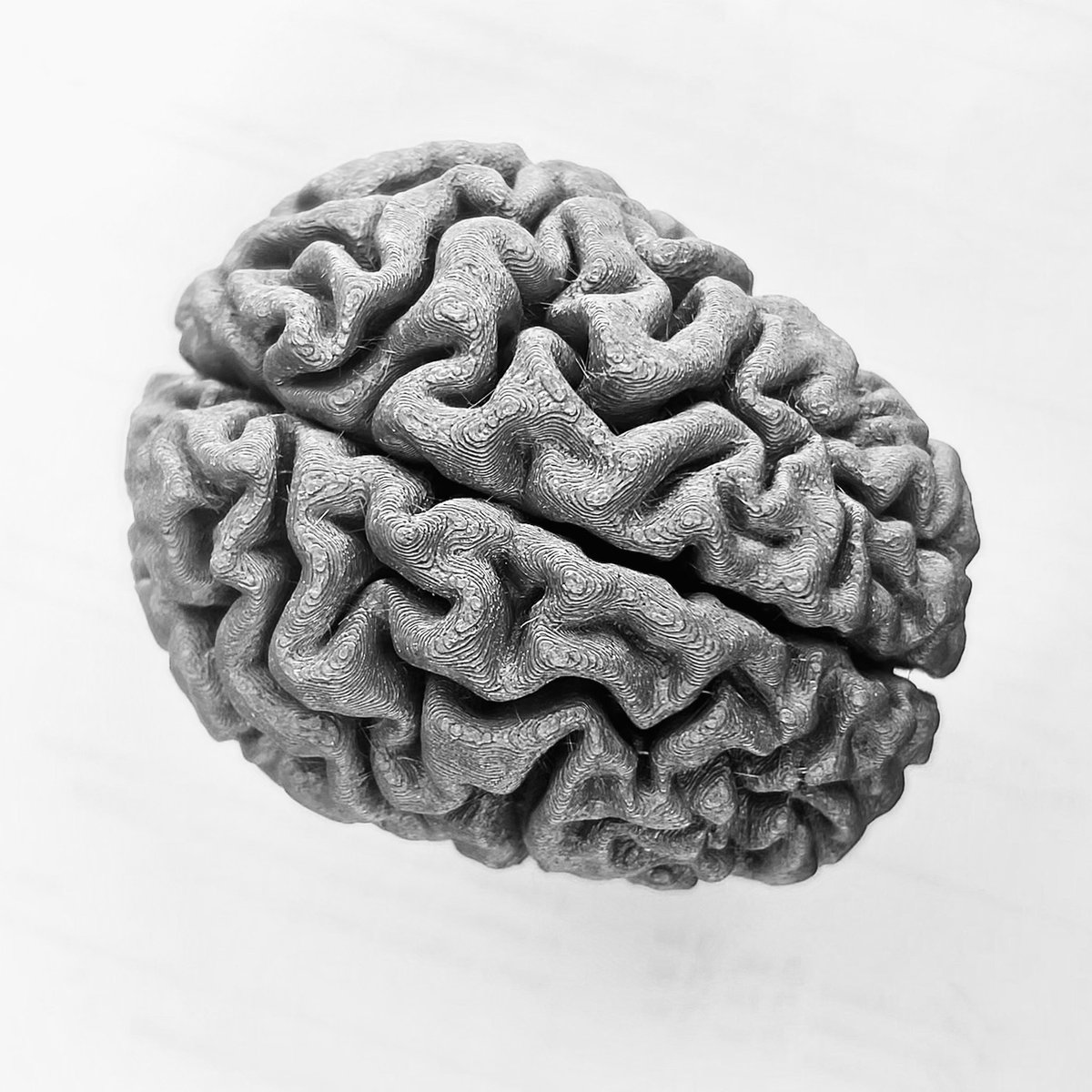 Dr Annabel Sorby-Adams (@asorby_adams) on Twitter photo The awesome <a href="/wtkimberly/">W. Taylor Kimberly</a> casually printed this 3D model of my brain last week. Greatest gift ever from the greatest mentor! The awesome <a href="/wtkimberly/">W. Taylor Kimberly</a> casually printed this 3D model of my brain last week. Greatest gift ever from the greatest mentor!