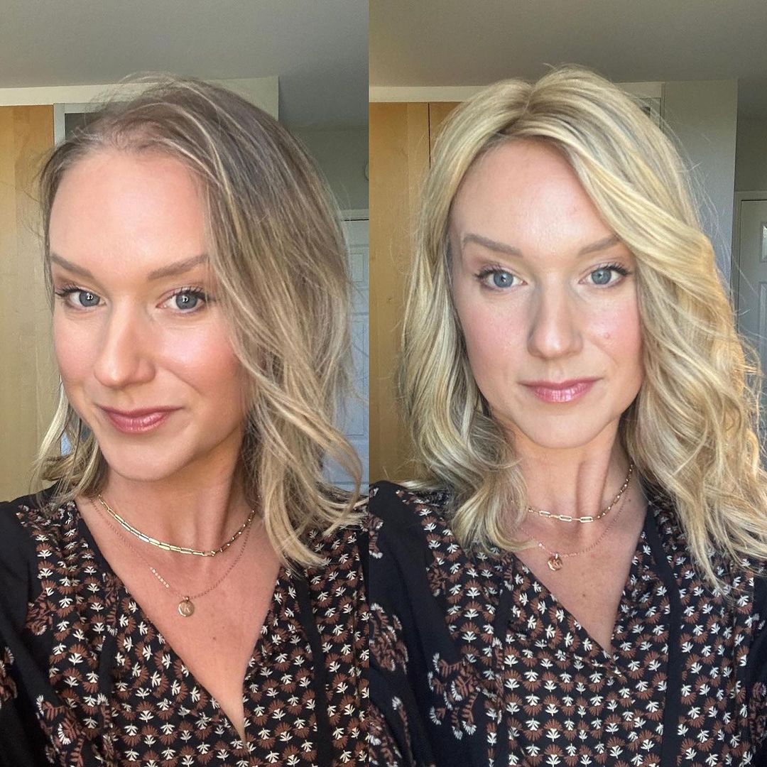 UniwigsC's tweet image. New Arrivals! 🙌
Hair topper featured:
Upgrade Courtney hair topper
Search 🔍 PM2303 at uniwigs.com.
✅Larger mono hand-tied area;
✅More affordable.
#hairtopper #hairtoppers #thinninghairsolution #hairtoppersforthinninghair #alopecia #hairloss