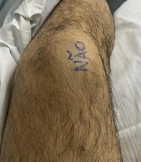 choquei's tweet photo. 🚨BRASIL: Homem escreve 'sim' e 'não' nas pernas antes de cirurgia para mostrar qual joelho deveria ser operado, no Ceará (G1). https://t.co/d2TaZPiMBv