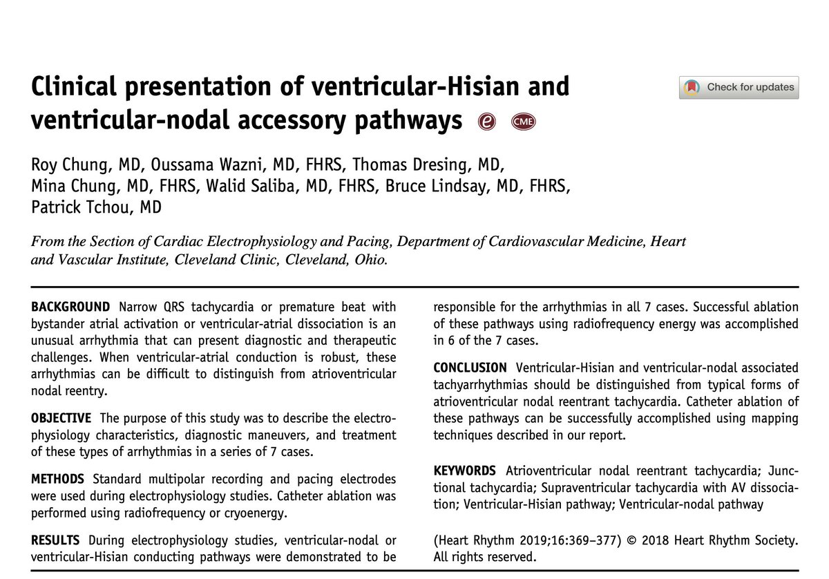 pzhong2016's tweet photo. Clinical presentation of ventricular-Hisian (VH) and ventricular-nodal (VN) accessory pathways https://t.co/ojxNWRrMR1
