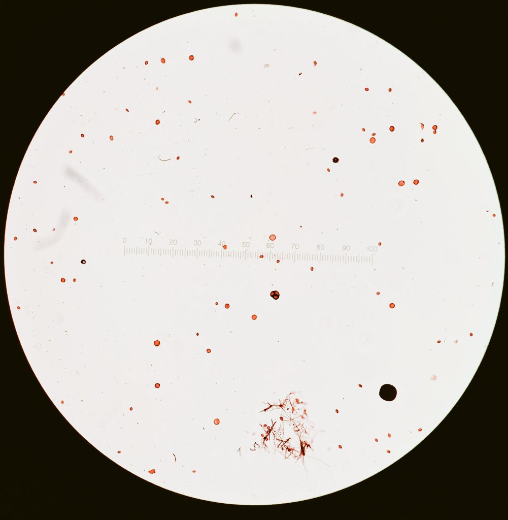 I love to analyse pollen from honey. This is from a town in Ourense, Galicia. The honey is the darkest that I've seen, really smooth taste, and the majority of pollen is from Sweet Chestnut. Different from the gold colour one here at RHUL, that is full of Horse Chestnut pollen.