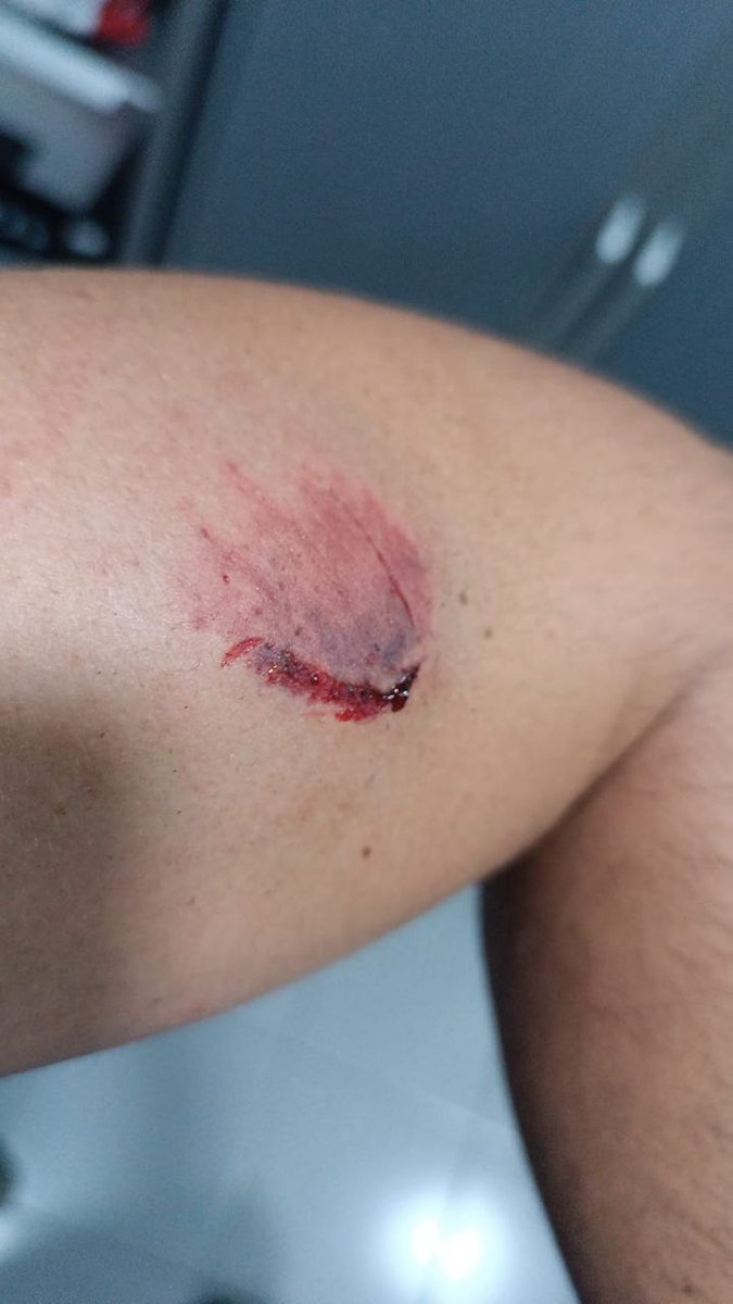 AEGC_CV's tweet photo. Compañero agredido durante la detención de un requisitoriado judicial en Villena. El autor, en la calle.

¿Hasta cuando tenemos que esperar la consideración de Autoridad?

¿Por qué no tenemos derecho a saber si el agresor tiene alguna enfermedad infectocontagiosa?

#AEGCdenuncia https://t.co/pHczStQB80