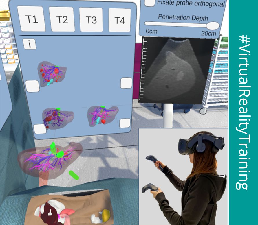 STIMULATE_FC's tweet photo. #ScienceInsight – Die Doktorandin Mareen Allgaier erforscht und erarbeitet mit einem interdisziplinären Team Virtual Reality Trainingsmethoden #VRtraining für medizinische Eingriffe, bspw. für die verbesserte Behandlung von Lebertumoren: https://t.co/BWNACOfyOS https://t.co/mE0V2ADBOi