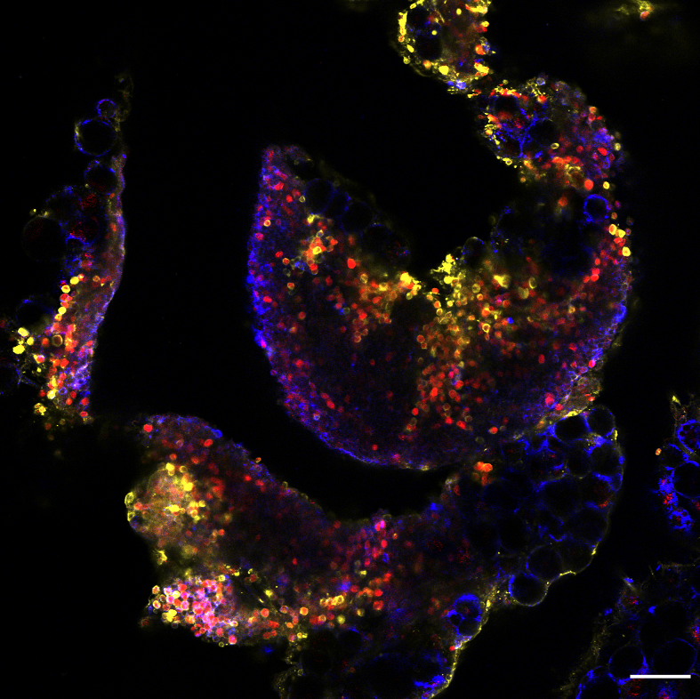 Dr Lucy Jackson-Jones (@lucyhjackson_j) on Twitter photo Do you know any finished BSc/MSc/MRes students looking for a funded PhD? @CoffeltLab & I have a project investigating pleural gamma-delta T cells available <a href="/BLSLancasterUni/">BLS Lancaster University</a> from Oct' 23 - application details 👉lancaster.ac.uk/lec/graduate-s…
Please RT far & fast due to tight deadline Do you know any finished BSc/MSc/MRes students looking for a funded PhD? @CoffeltLab & I have a project investigating pleural gamma-delta T cells available <a href="/BLSLancasterUni/">BLS Lancaster University</a> from Oct' 23 - application details 👉lancaster.ac.uk/lec/graduate-s…
Please RT far & fast due to tight deadline