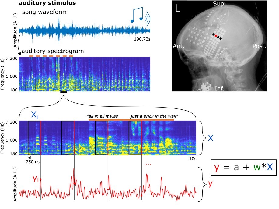 'A brick in the wall': reconstruction of a @PinkFloyd song from recorded neural activity, revealing involvement of the #SuperiorTemporalGyrus in information processing during #MusicPerception. Implications for #BrainComputerInterface #PLOSBiology plos.io/47zOgve