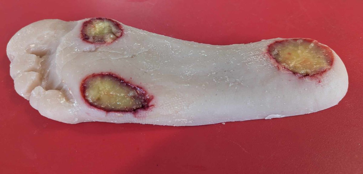 We're pretty excited about our new foot wound models for practicing sharp debridement and wound bed preparation 🔪
Many more 'hair-raising' models on their way 👀🦵🦶