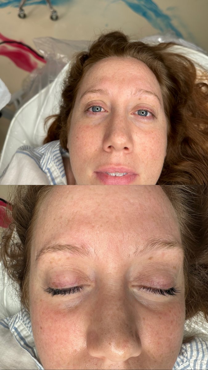 BbeautyArtistry's tweet image. My lash lifts are designed to last, bringing out your beautiful natural lashes and curl without needing extensions or false lashes. Call BBeauty.Artistry today at (973) 791-4763! 

#LashLift bit.ly/3Obgof4