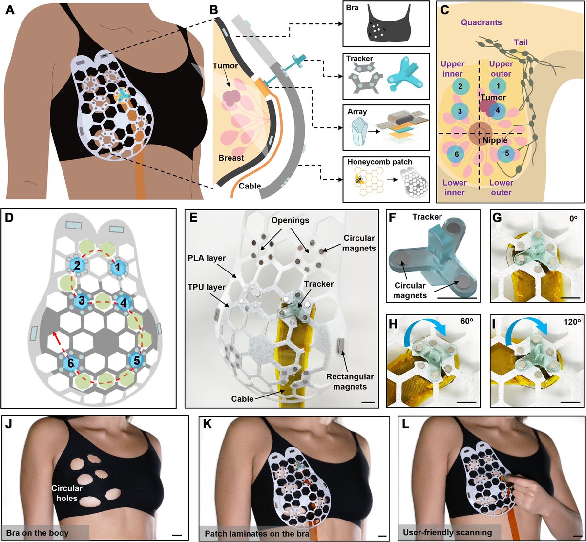 sahar_Mphys's tweet photo. Ultrasound breast patch(Wearable Ultrasound Scanner) for early detection of breast cancer
I love technology🤯 https://t.co/2fXkbqJSoU