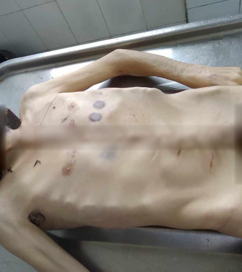 abaghyan_a's tweet photo. A person died from starvation in Artsakh https://t.co/CoZIuWqN2d
