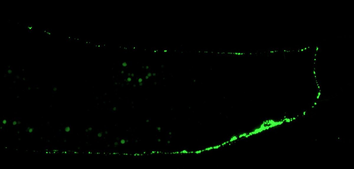 YaleNeuro's tweet photo. New study published in @CurrentBiology, led by first author @Sophistarete from @LabYogev
 and @PDClab, reveals key to axonal transport 🪱🧠. Read more: https://t.co/MaaC1wJyjS and full article: https://t.co/CmoXuRqZvW https://t.co/VR8Lh3XL9h