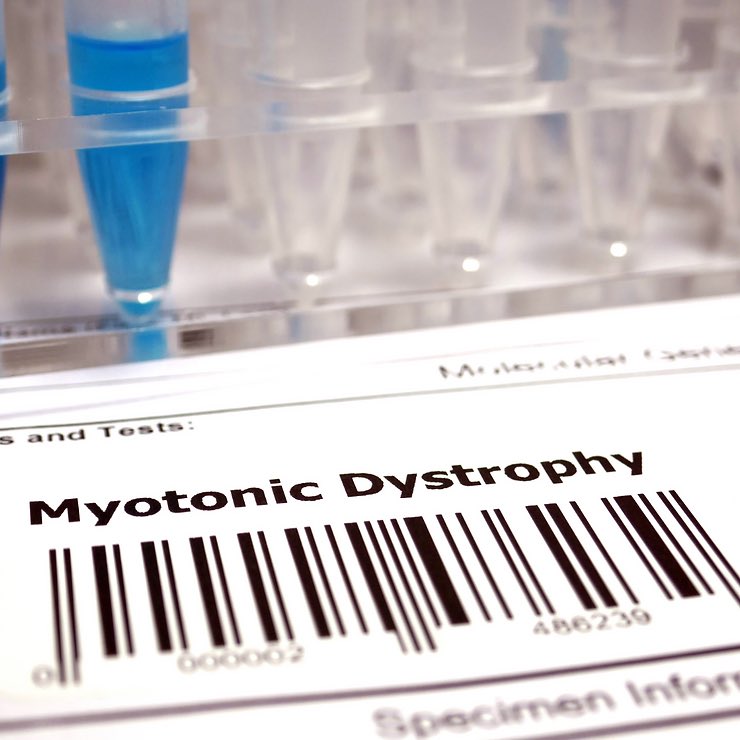 Unraveling the Challenges of Myotonic Dystrophy: Understanding the Diagnosis and Living with
Introduction

Myotonic Dystrophy (DM) is a complex and often misunderstood genetic disorder that affects thousands of individuals worldwide.
myotonicdystrophycoach.com/post/unravelin…

#AnnWoodbury