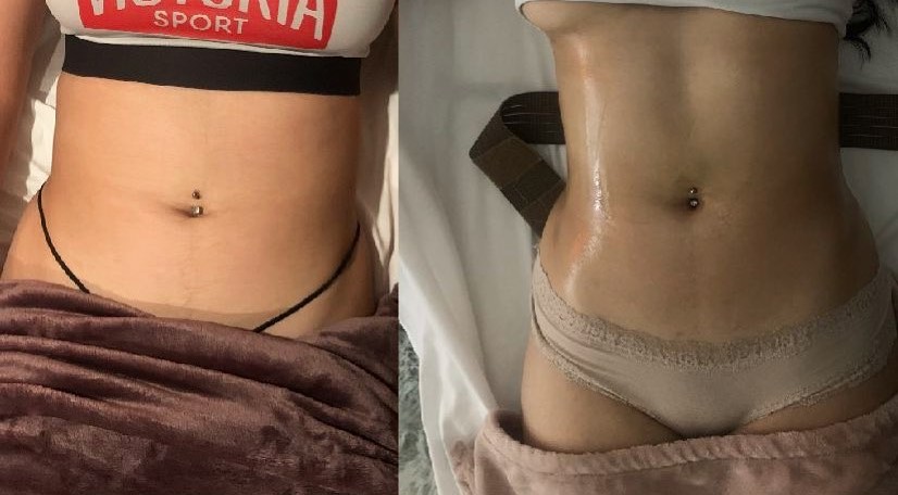 Est2023Moncheri's tweet photo. Whether you want a slight transformation or a dramatic change, my body contouring service will help you get the body of your dreams. Visit my website today to book an appointment!

#BodyContouring https://t.co/sgggeujiJz https://t.co/EmXNizVmvy