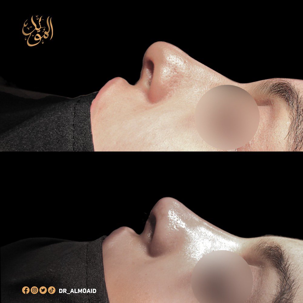 Dr.Almoaidbellah Rammal د.المؤيدبالله رمال tweet media