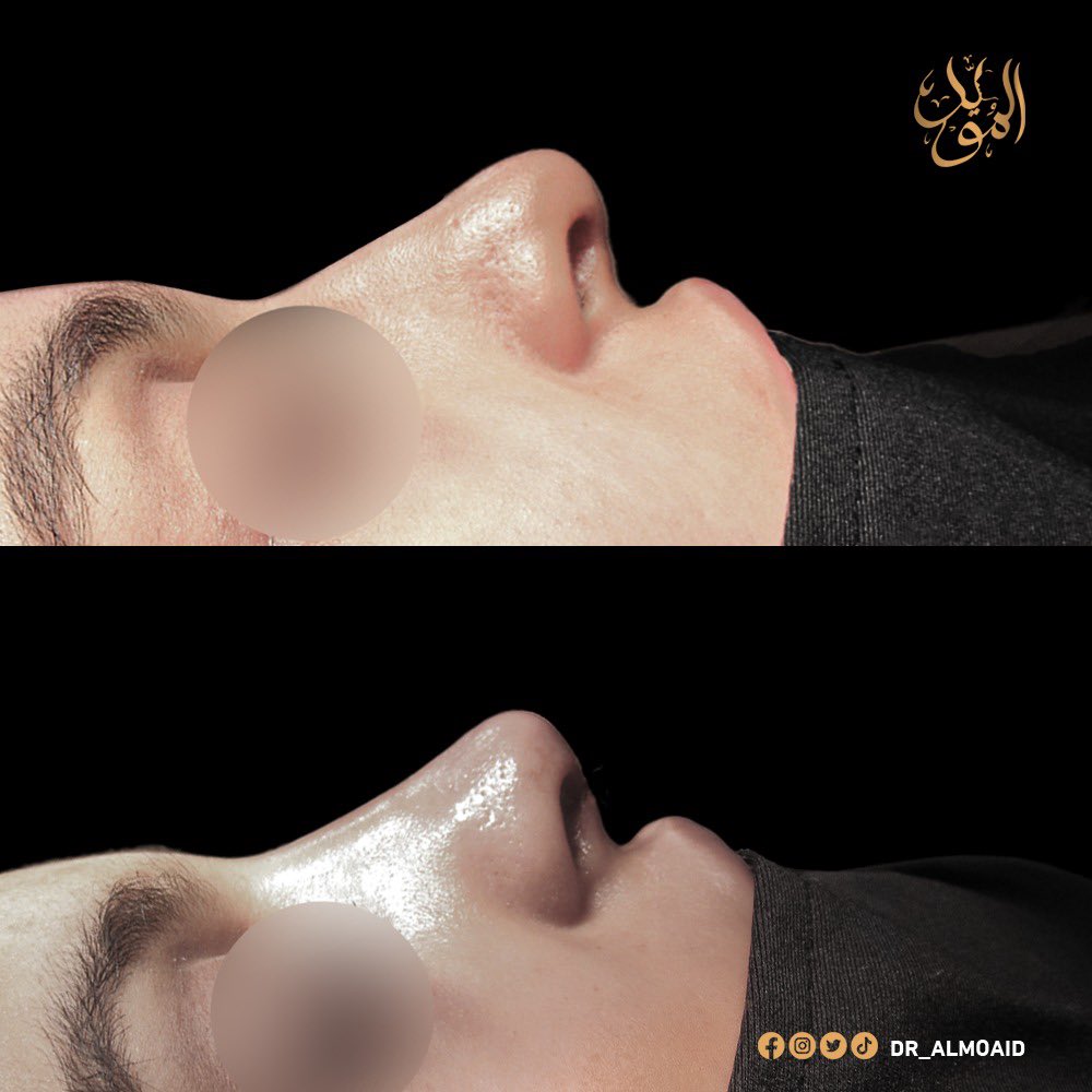 Dr.Almoaidbellah Rammal د.المؤيدبالله رمال tweet media