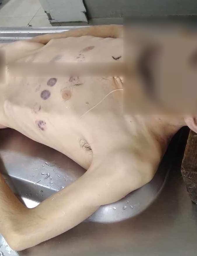 Tragic Death in Artsakh due to Starvation 😢

A resident of Stepanakert, K. Hovhannisyan, 1983-2023, died of severe malnutrition caused by ongoing blockade. Lack of food, medicines, and healthcare threatens 120,000 people, impacting vulnerable groups. #Artsakh #ArtsakhBlockade