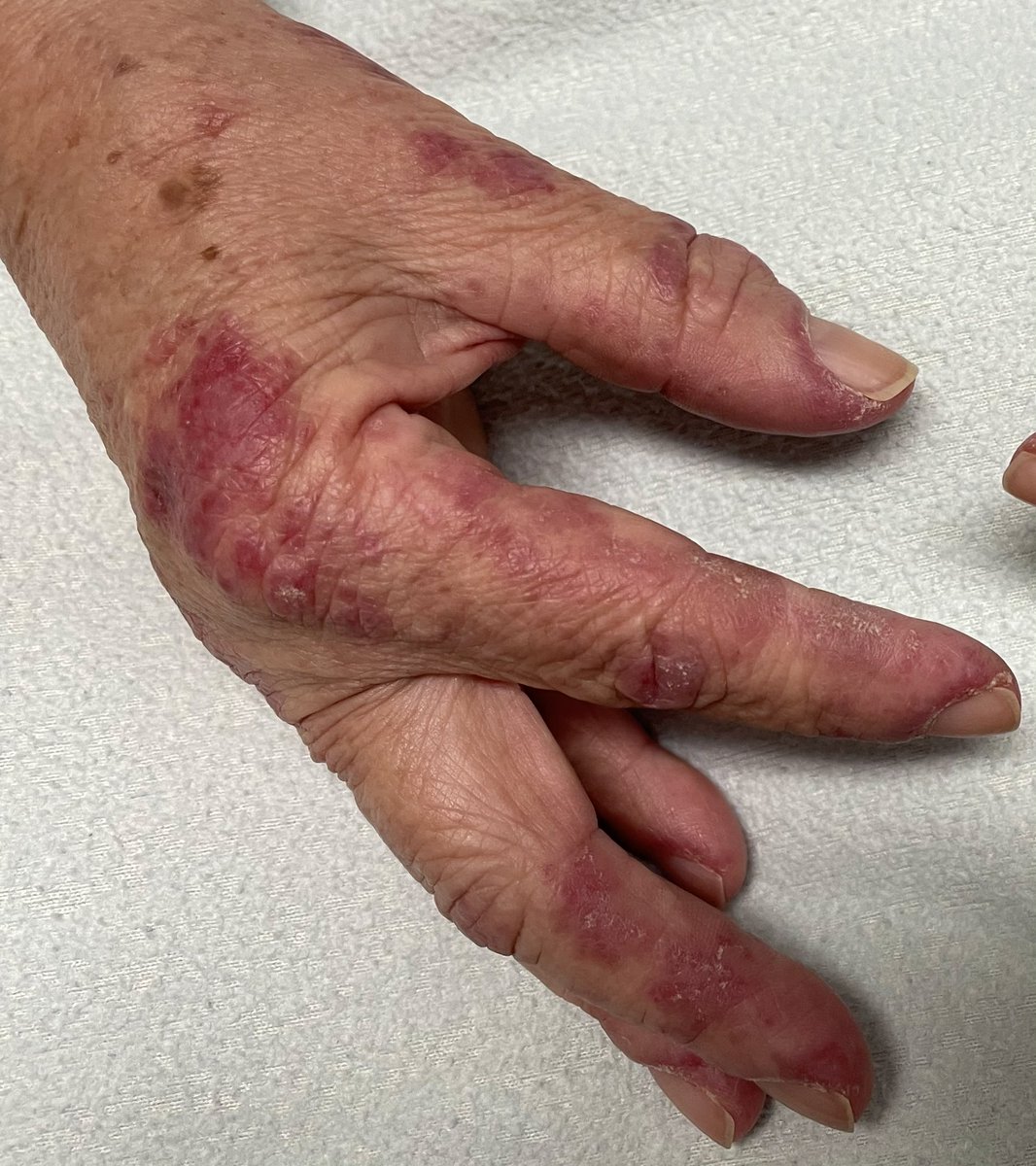 A veces el diagnóstico está en las🖐🏼