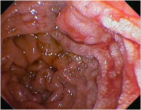 ASGE GI Endoscopy tweet media