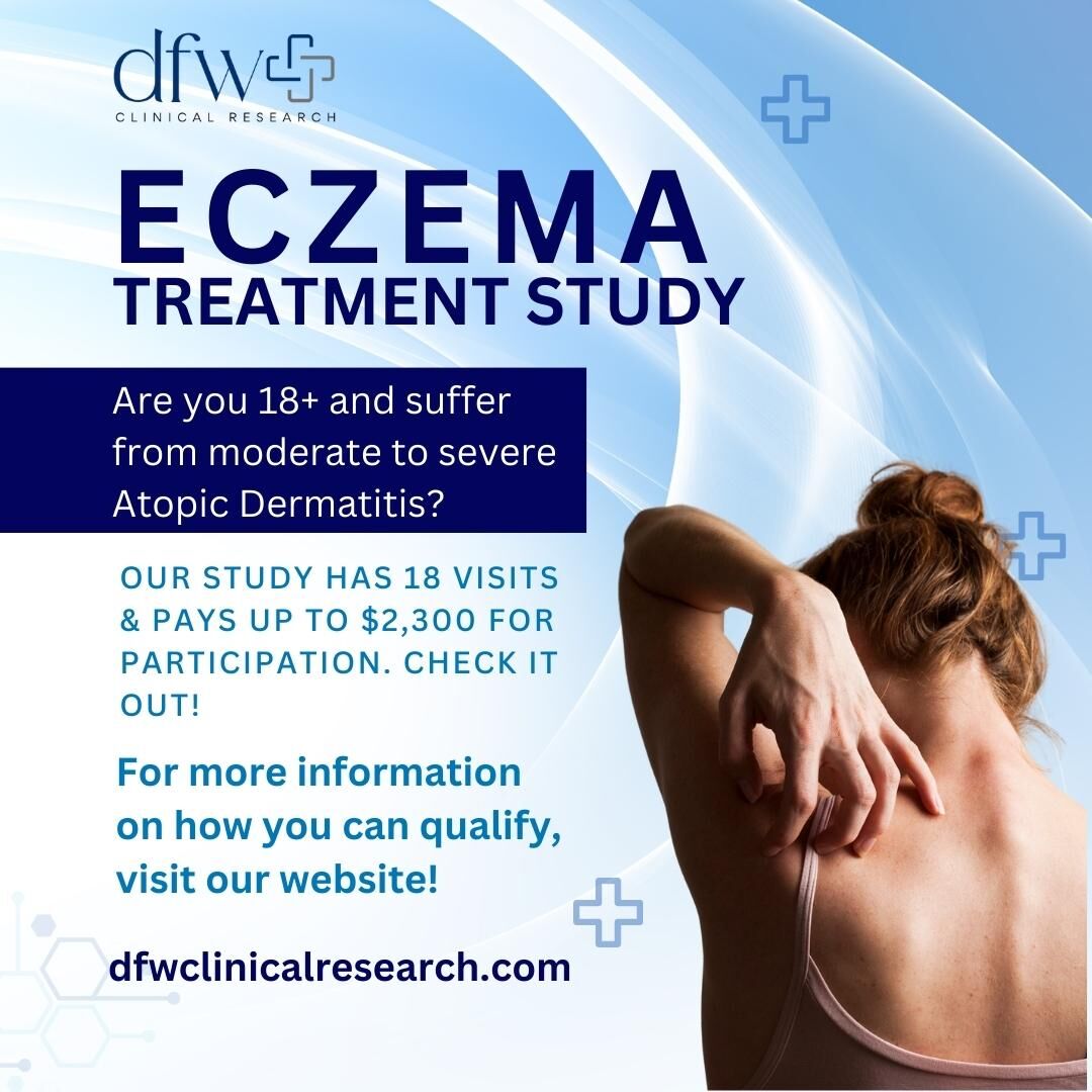 Want to contribute to Atopic Dermatitis research? Participate in our clinical study and help advance medical knowledge. 

Visit dfwclinicalresearch.com/ongoing-studie… to find out more about this exciting opportunity.

#AtopicDermatitisStudy #EczemaResearch #SkinCondition #ClinicalResearch