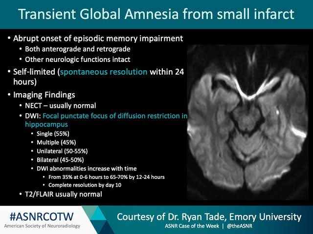 Transient Global Amnesia The Long Term Risk Of Dementia After