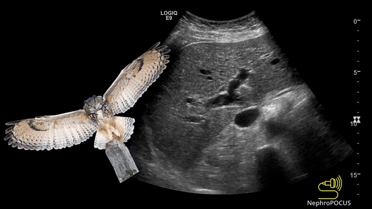 NephroP's tweet photo. #POCUS quiz #2
What's the bird in this #ultrasound image?
POLL in thread.
#FOAMed #FOAMcc https://t.co/WtDiAxs4sb