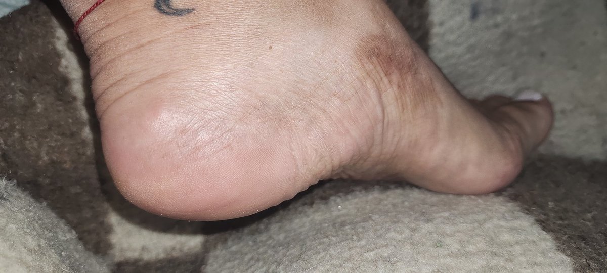 FeetsOnline's tweet photo. #feet_lover #feetpic #feetcontent #feetfethish #feetfetiche #feetworshi̇p #mefee #nature #lovefeet #feets #Turku #Liban #dubai https://t.co/G4bKMJMtIQ