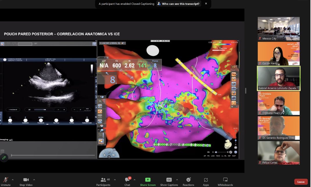 CarinaHardy4's tweet photo. Primer día do curso para fellows Leaders of tomorrow by @BiosenseWebster 
Día de #AtrialFibrillation 

Aula MASTERCLASS de FA seguida de 
discusión de casos interesantes por panelistas de excelencia de LATAM

#EPeeps  
#WomenInEP  
#FellowEp https://t.co/sjaSzQeoQ9