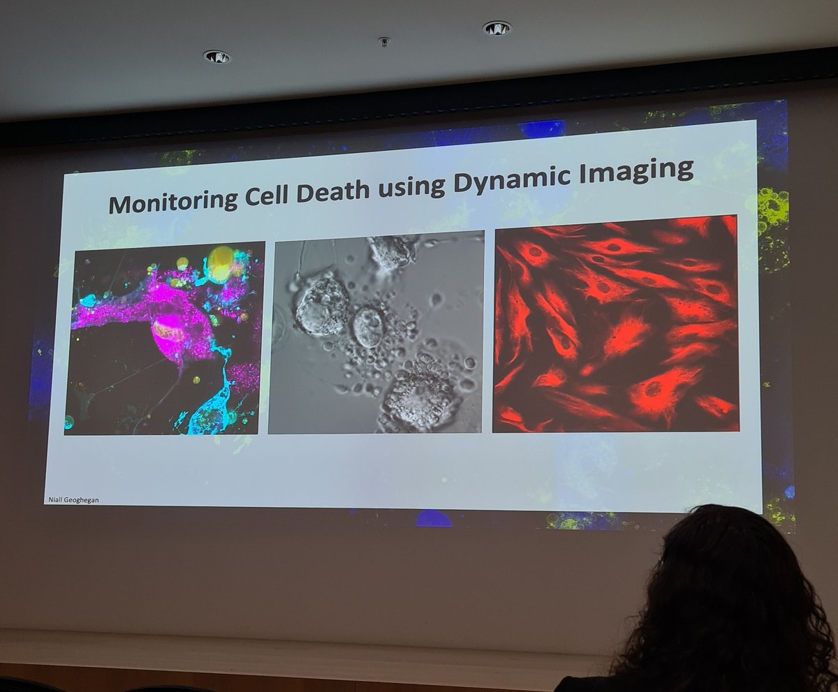 Our very first student presenter, Stephanie Rutter <a href="/LIMSLTU/">La Trobe Institute for Molecular Science</a>, displayed her spectacular imaging work characterising the "Footprint of Death" formed during apoptosis! 🤩🤯
#JAM2023 <a href="/LabACDC/">ACDC Lab</a>
