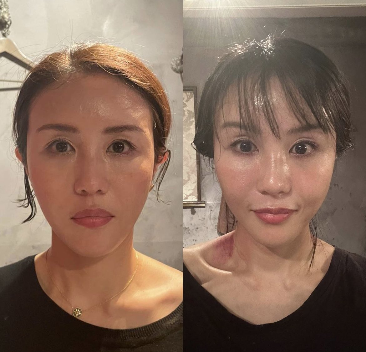 左39歳　右41歳

改めて比べたら🤣
もちろん整形なし！

#セルライトクラッシュ
#ハーブピーリング
だけ！