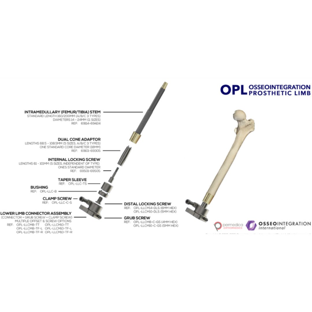 BoneJointOpen's tweet image. One-stage approach of an osseointegrated prosthesis is favourable compared to a two-stage approach. Incidence of complications was found to be slightly lower in the one-stage cohort.

#Orthopedics #BoneImplant #Prosthesis #BJO

ow.ly/QxSj50PoaYf