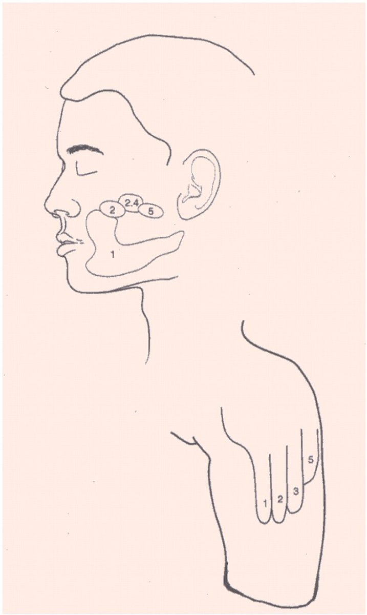 Paper alert! Many of us assume that when amputees feel a touch on their face, they also sense it in their missing hand, all thanks to brain plasticity. But what if this is based on flawed scientific evidence? Here’s a breakdown of our paper doi.org/10.1016/j.cort…