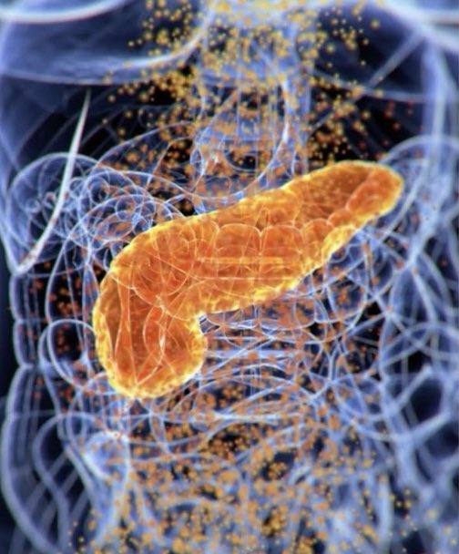 İnsülin direnci çağımızın en önemli ve yaygın problemlerinden biridir.. Tedavi edilmezse; Şeker hastalığına, böbrek ve kalp hastalıklarına, görme problemlerine, inme ve alzheimer gibi birçok kronik hastalığa yol açabilir.

İnsülin direnci neden olur? Nasıl geriye döndürebiliriz?