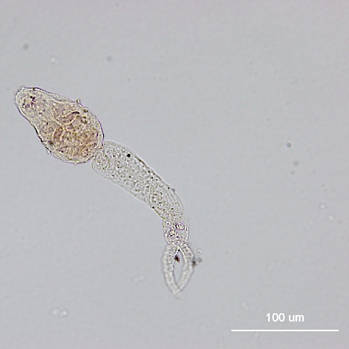 #MicrobeoftheMonth! Can you guess who I am?

1. I need snails to complete my life cycle.
2. After stops in the lungs, heart & liver, I generally end up near the small intestine of my host.
3. Symptoms of infection are associated with responses to my eggs.

Leave a guess below!