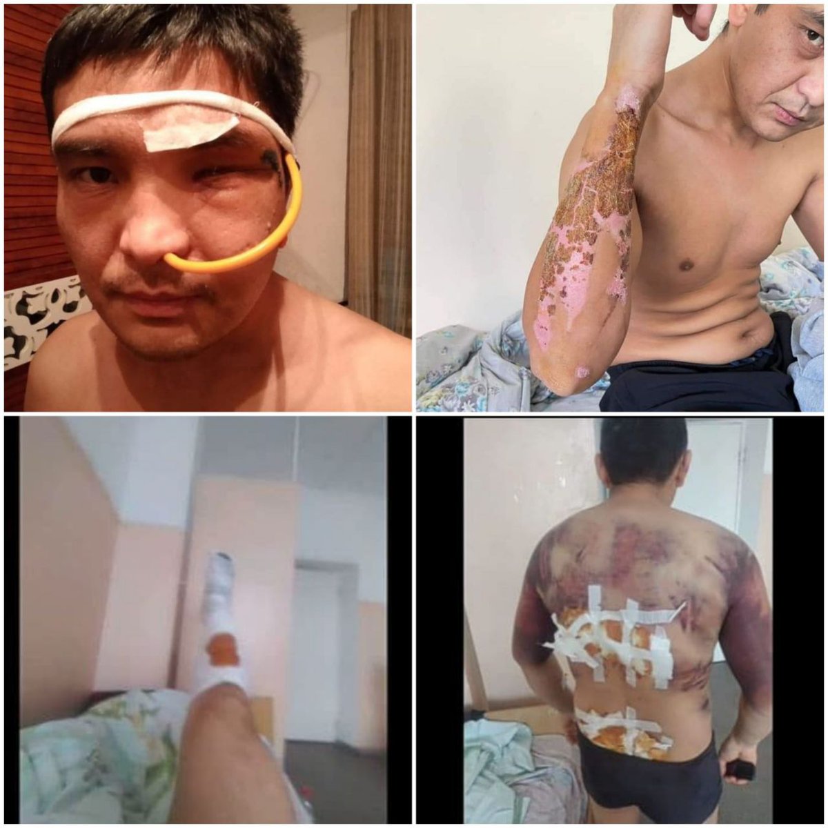 JomartAbdigapar's tweet photo. 1/3
There can be no question of "dignity" in a country where the main right, the right to life, is not respected. Those responsible for the murder of 238 people and the #torture of thousands of people in #ProtestJanuary2022 walk free.
@CommissionerHR
@RTSinfo
#KazakhstanProtests https://t.co/zcGG8sroIT