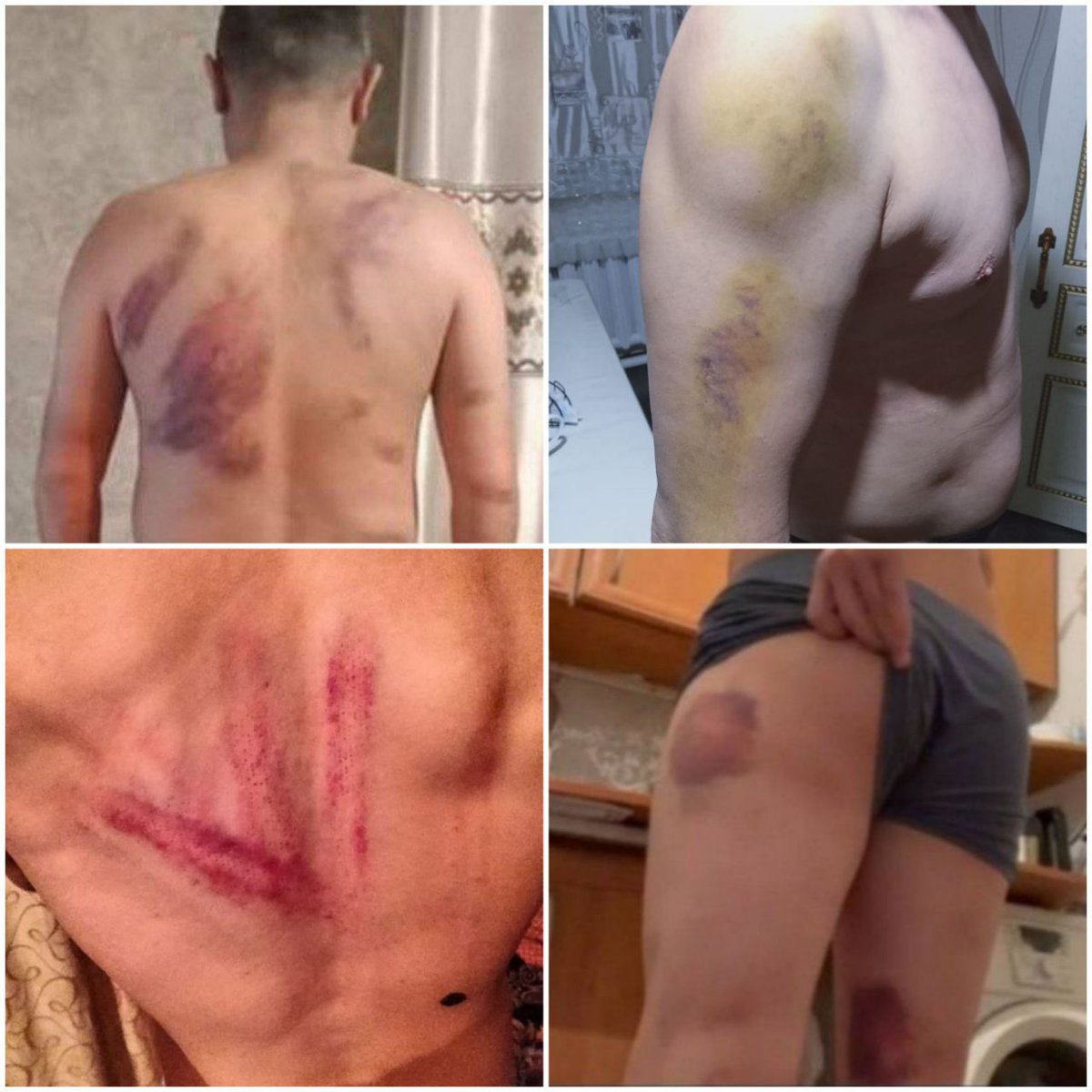 JomartAbdigapar's tweet photo. 1/3
There can be no question of "dignity" in a country where the main right, the right to life, is not respected. Those responsible for the murder of 238 people and the #torture of thousands of people in #ProtestJanuary2022 walk free.
@CommissionerHR
@RTSinfo
#KazakhstanProtests https://t.co/zcGG8sroIT
