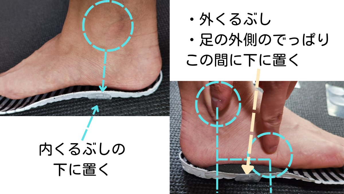 kobakutsu's tweet photo. 【DIY】ダイソー商品で全般的に足を支えるインソール自作

・扁平足傾向
・ねこ背傾向の人
・膝が内に入りやすい人

におすすめです。元々靴についているインソールの裏に貼るのですが、一つの商品で両足分できます。外れやすい場合はテープで固定しましょう。

貼り方が超大事！！！ https://t.co/eYtgW7Hu11