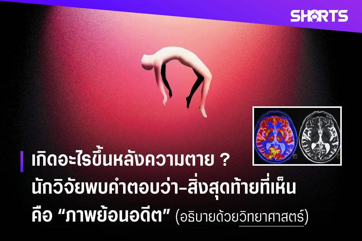 0xCatsFund's tweet photo. เกิดอะไรขึ้นหลังความตาย ? นักวิจัยทำการตรวจคลื่นสมองของผู้ป่วยหลังเสียชีวิตไป 15 นาที พบว่าทฤษฎี “Flash Before your eyes” หรือ “ภาพย้อนเหตุการณ์ความทรงจำทั้งหมดในชีวิต” อาจเป็นเรื่องจริง
.

นักวิจัยจากอเมริกาได้ทำการบันทึกคลื่อนสมอง (EEG) กับผู้ป่วยโรคลมบ้าหมูวัย 87 ปี ที่เสียชีวิตหลังหัวใจวายได้ 15 นาที ตรวจพบการเพิ่มขึ้นของคลื่นสมองที่เรียกว่า “Gamma Oscillations” ซึ่งเชื่อมโยงกับทฤษฎี “flashes before their eyes” หรือก็คือ “การเห็นภาพย้อนอดีต” นั่นเอง
.

งานวิจัยนี้ได้รับการตีพิมพ์ลงวารสาร Frontiers in Aging Neuroscience ระบุว่า “การเพิ่มขึ้นของคลื่นสมองดังกล่าวเกี่ยวข้องกับการดึงความทรงจำต่าง ๆ ที่สำคัญในชีวิตเป็นครั้งสุดท้ายก่อนที่สมองจะหยุดทำงานอย่างสมบูรณ์ ซึ่งการทำงานของคลื่นสมอง Gamma Oscillations เป็นการตอบสนองเดียวกันเมื่อเรานึงถึงเหตุการณ์ในอดีต หรือใช้สมองทบทวนสิ่งต่าง ๆ นั่นเอง”
.

ดร.อัจมาล เซมมาร�� ผู้เขียนรายงานเรื่องนี้กล่าว “รายงานการวิจัยนี้สอดคล้องกับคำบอกเล่าของผู้ที่ประสบเหตุการณ์เฉียดตายมาแล้ว เช่น ผู้ที่รอดชีวิตจากการตกตึก ผู้รอดชีวิตจากการถูกยิง หรือผู้ฟื้นขึ้นมาหลังหัวใจหยุดเต้นไปแล้ว ว่าพวกเขาเห็นภาพย้อนอดีตทั้งสิ้นในจังหวะที่รู้ว่าตัวเองกำลังจะเสียชีวิต ”
.

โดยการทดลองของดร.เซมมาร์ นับว่าเป็นครั้งแรกที่สามารถตรวจจับคลื่นสมองแบ���นี้ได้หลังเสียชีวิต เนื่องจากก่อนหน้านี้จะสามารถตรวจจับได้เฉพาะในหนูทดลองเท่านั้น แต่ถึงอย่างนั้นก็ไม่สามารถสรุปได้ทั้งหมด เพราะเป็นการทดลองเพียงกรณีศึกษาเดียวเท่านั้น ไม่แน่ใจว่าคลื่นสมองแบบนี้จะเกิดกับมนุษย์ทุกคนที่เสียชีวิตหรือไม่
.

อย่างไรก็ตาม สิ่งที่เราได้เรียนรู้จากงานวิจัยในครั้งนี้ คือแม้ว่าคนที่เรารักได้หลับตาและพร้อมจะจากไปแล้ว อาจเป็นช่วงเวลาที่พวกเขากำลังนึกถึงเรื่องราวที่ดีที่ส��ดที่เคยผ่านมาในชีวิตอยู่ก็เป็นได้