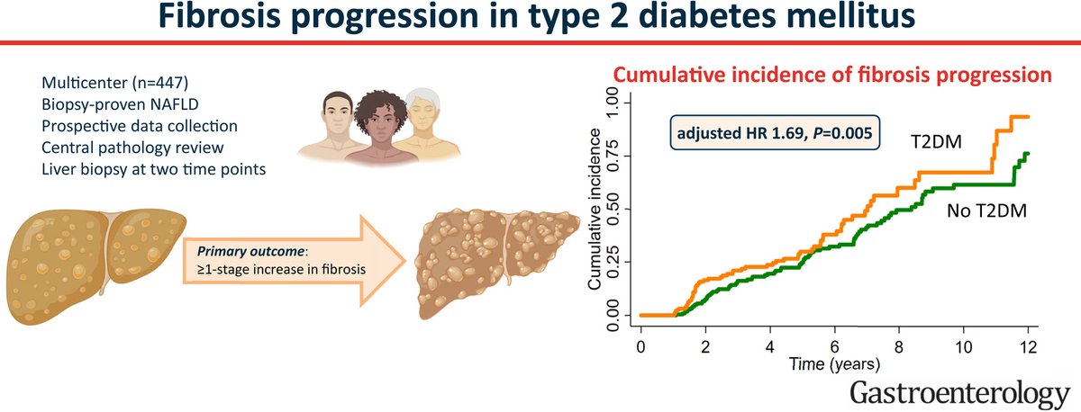 Gastroenterology (@aga_gastro) on Twitter photo In this large, multicenter study, Huang and colleagues demonstrate that liver fibrosis progresses faster in people with diabetes, compared to people without diabetes <a href="/DrHuangDQ/">Daniel Huang</a> <a href="/DrLoomba/">Rohit Loomba</a> ➡️ ow.ly/TzUK50PvXZR In this large, multicenter study, Huang and colleagues demonstrate that liver fibrosis progresses faster in people with diabetes, compared to people without diabetes <a href="/DrHuangDQ/">Daniel Huang</a> <a href="/DrLoomba/">Rohit Loomba</a> ➡️ ow.ly/TzUK50PvXZR