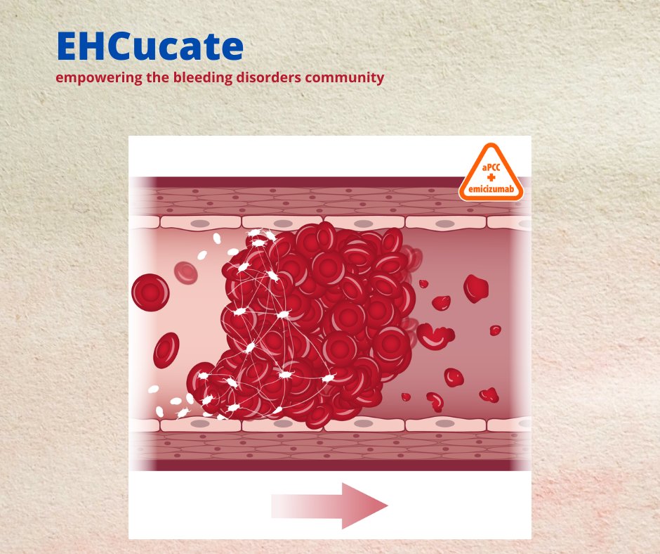 EHC_Haemophilia's tweet photo. In emicizumab #ClinicalTrials some #SideEffects were only reported in people taking significant amounts of #aPCCs. The most severe side effect reported in people combining Emi and aPCCs is the formation of clots in small blood vessels, called thrombotic #microangiopathy or #TMA. https://t.co/p0sbf8ztDT