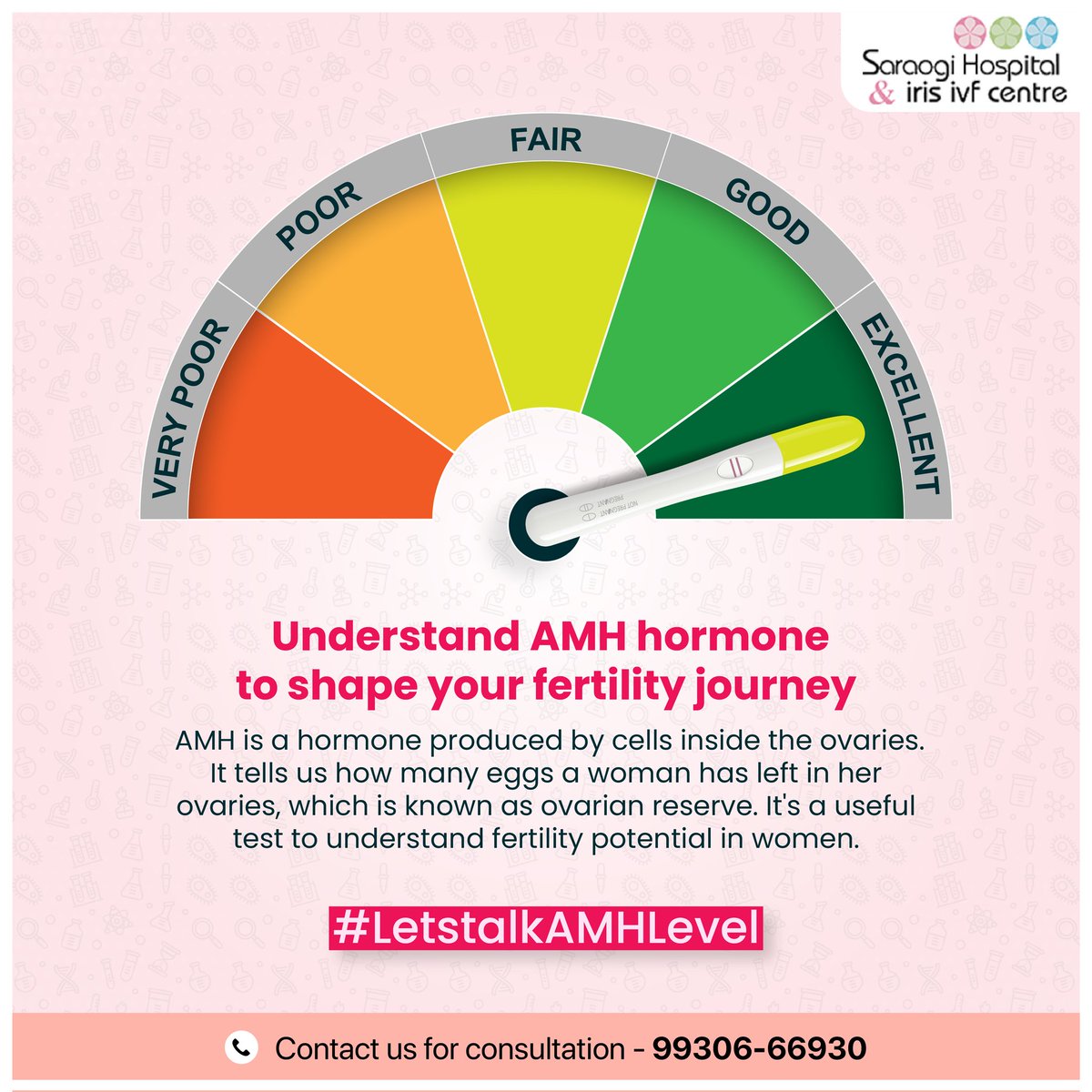 HospitalSaraogi's tweet image. AMH, or anti-Müllerian hormone, is a hormone released by ovarian follicles; hence, the higher your level, the more follicles are likely to have. AMH testing is commonly used to determine your egg count. 

To know more call us on 99306-66930

#saraogi #amhlevels #amh #ivfcenter