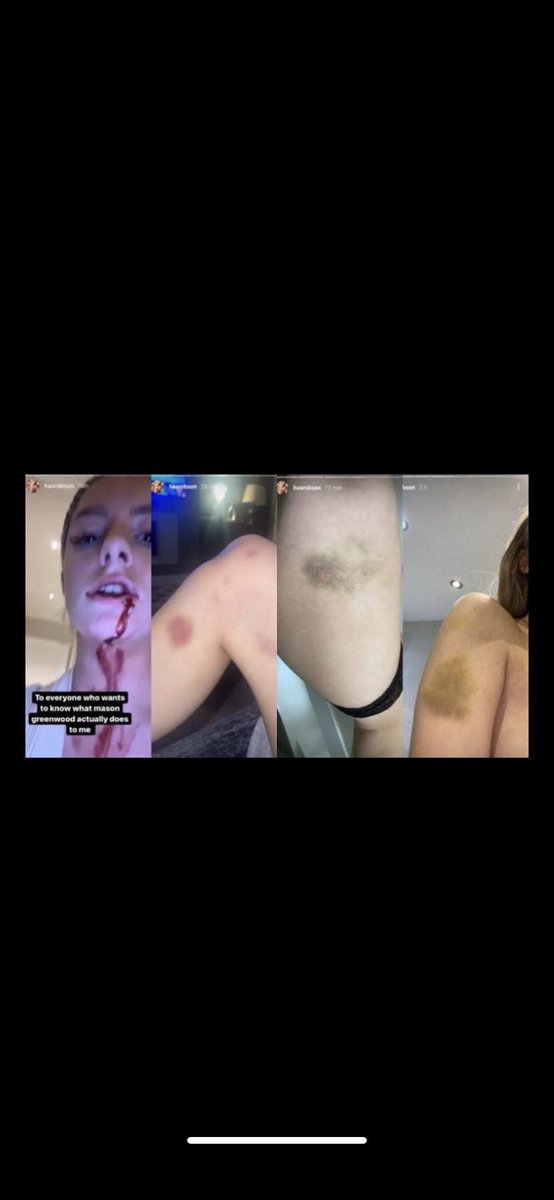 <a href="/knaggsy097/">TrevUTID</a> As a  United fanatic who has a daughter. 
He’s out and should stay out. 👊🏻🇾🇪👊🏻
He’s not welcome.