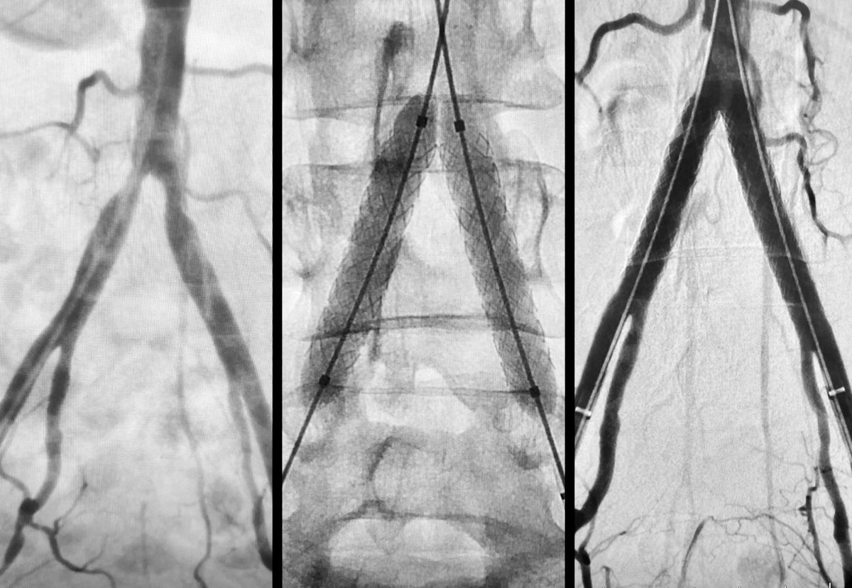 It is that kinda day..!! 😀 <a href="/SIR_ECS/">SIR ECS</a> <a href="/SIRspecialists/">Society of Interventional Radiology</a> <a href="/SIRRFS/">SIR RFS</a>