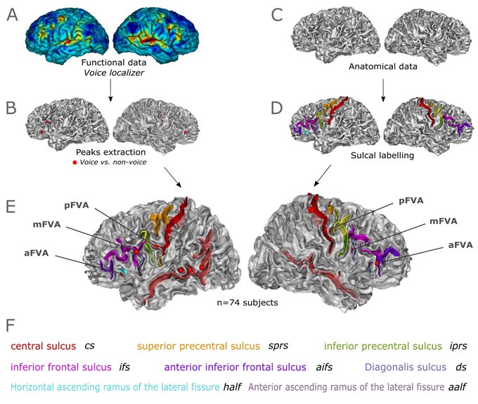💥Exciting news! Stay tuned for the unveiling of my inaugural first-author paper! Intriguing revelations about the relationship between structural and functional aspects within human sulci and voice areas await you #NeuroImage #ComingSoon 🧠