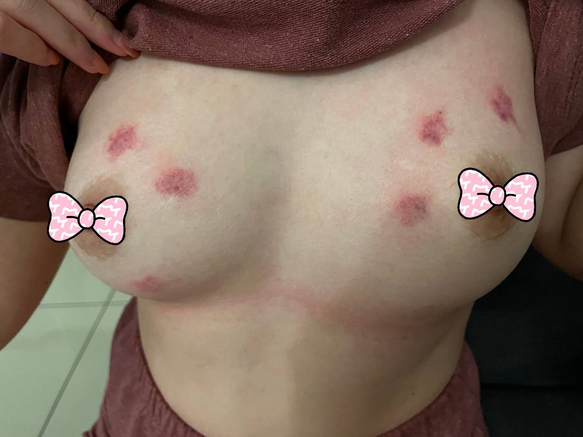 吸血鬼

🍓