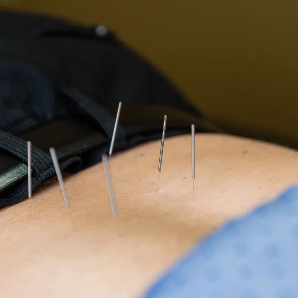 By balancing your energy and revitalizing your health, #acupuncture can be used to treat headaches and migraines, allergies, muscle pain and spasms, digestive problems, and many other ailments. Visit my website today to book online.