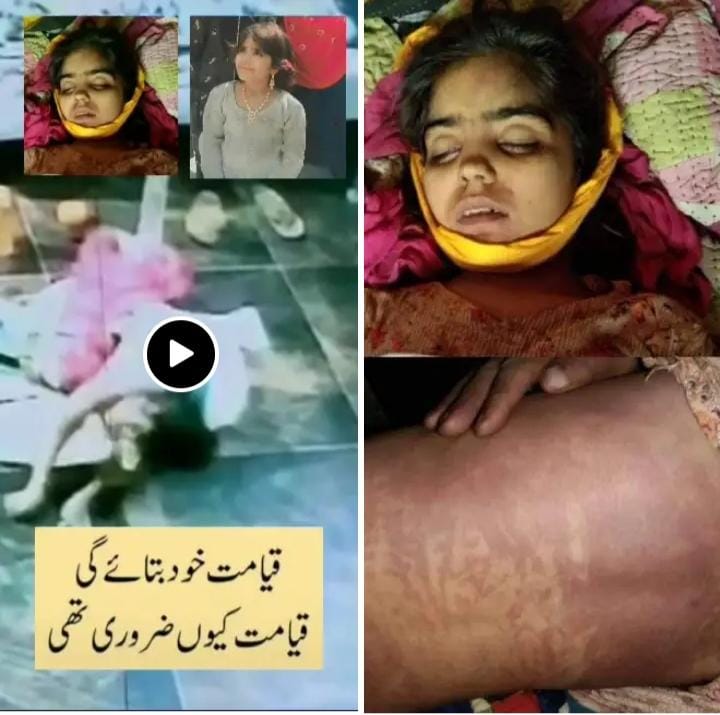 AdnanA_007's tweet photo. ضلع خیرپور کی تحصیل رانی پور میں بااثر پیر اسد شاہ کی حویلی میں کام کرنے والی 10 سالہ فاطمہ تشدد سے جان بحق ہو گئی جبکہ بچی کے جسم پر تشدد کے نشانات واضح طور پر دیکھے جا سکتے ہیں.کل اس درندے نے بچی کے گھر والوں کو فون کر کے کہا کہ فاطمہ کچھ دن سے بیمار تھی اور آج فوت ہ��گئی ہے اس کی لاش لے جاؤ.جب بچی کو غسل دیا گیا تو اس کے جسم پر تشدد کے نشانات واضح نظر آئے لیکن غریب ورثاء نے پوسٹ مارٹم اور میڈیکل کے بغیر بچی کو دفن کر دیا.عین ممکن ہے تشدد کے ساتھ زیادتی بھی کی گئی ہے لیکن ملزم بااثر ہیں پولیس نے ملزم کی پشت پناہی کرتے ہوئے کہا کہ بچی کے ورثاء کے مطابق اس کے پیٹ میں درد تھا اور وہ فوت ہو گئی اس کے جسم پر کوئی تشدد کے نشانات نہیں ہیں.نگران وزیراعلیٰ سندھ فوری طور پر اس واقعہ کا نوٹس لے کر انکوائری کروائیں.