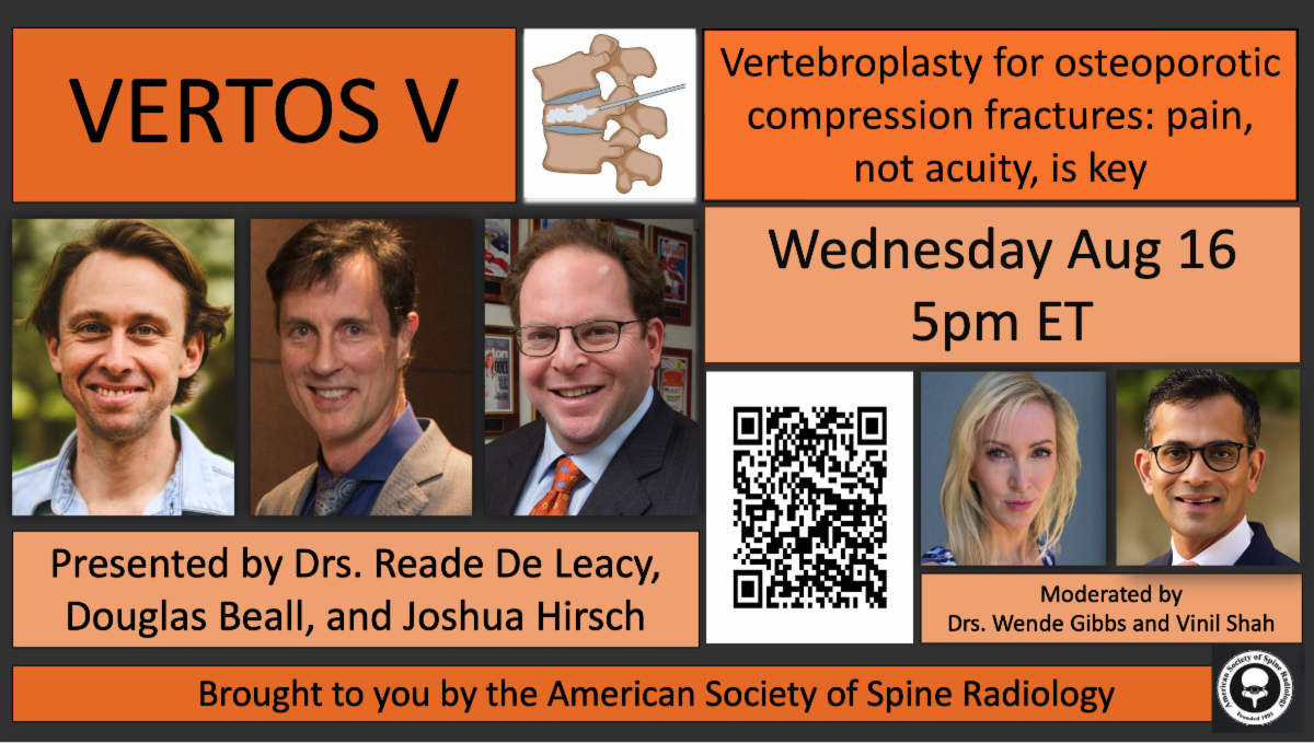 There is still time to register for the VERTOSV webinar happening today 5pm EST! buff.ly/4583K7B @WendeNGibbs @vinil_shah @JoshuaAHirsch @dougbeall #SPINE #NeuroRad #MSKRad