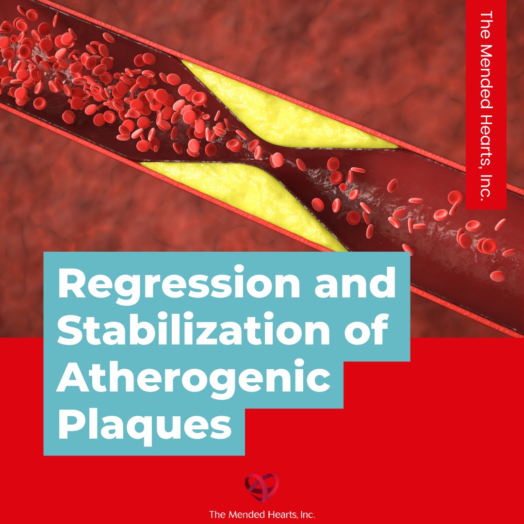 MendedHearts's tweet photo. #CardiacTwitter: Do you know the effects Atherosclerotic plaque has on your #HeartHealth? Learn more about the #CardiovascularCommunity initiative of plaque regression and stabilization.
🔗https://t.co/A7qOxZrWAh https://t.co/Fk0MtevnlK