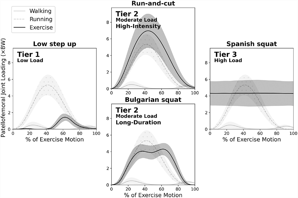 AOSSM Journals (@aossmjournals) on Twitter photo Patellofemoral joint loading varies across 35 common rehab exercises. <a href="/BaxterLabHQ/">BaxterLabHQ</a> provide clinicians with a modifiable Loading Index rank system to choose exercises that promote therapeutic loading.
ow.ly/IUcy50PywvJ Patellofemoral joint loading varies across 35 common rehab exercises. <a href="/BaxterLabHQ/">BaxterLabHQ</a> provide clinicians with a modifiable Loading Index rank system to choose exercises that promote therapeutic loading.
ow.ly/IUcy50PywvJ